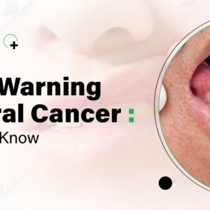 Oral Cancer