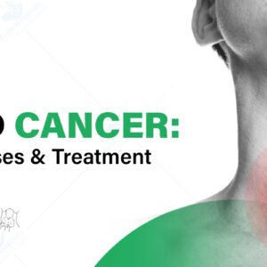 Thyroid Cancer